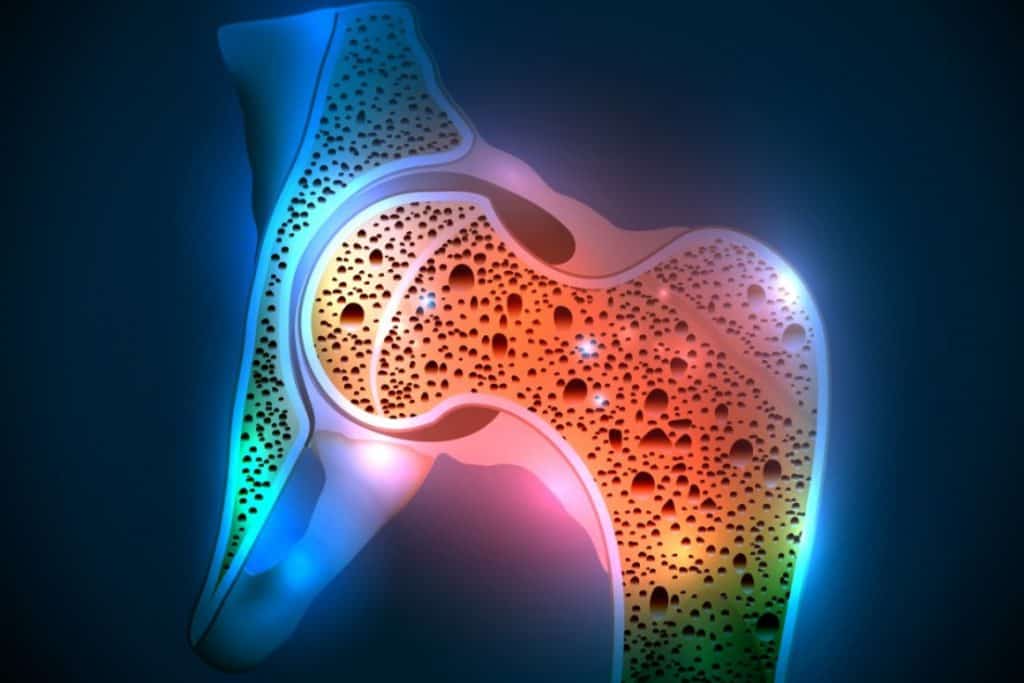 ماهي أسباب هشاشة العظام ؟ وكيف تتعايش مع المرض
