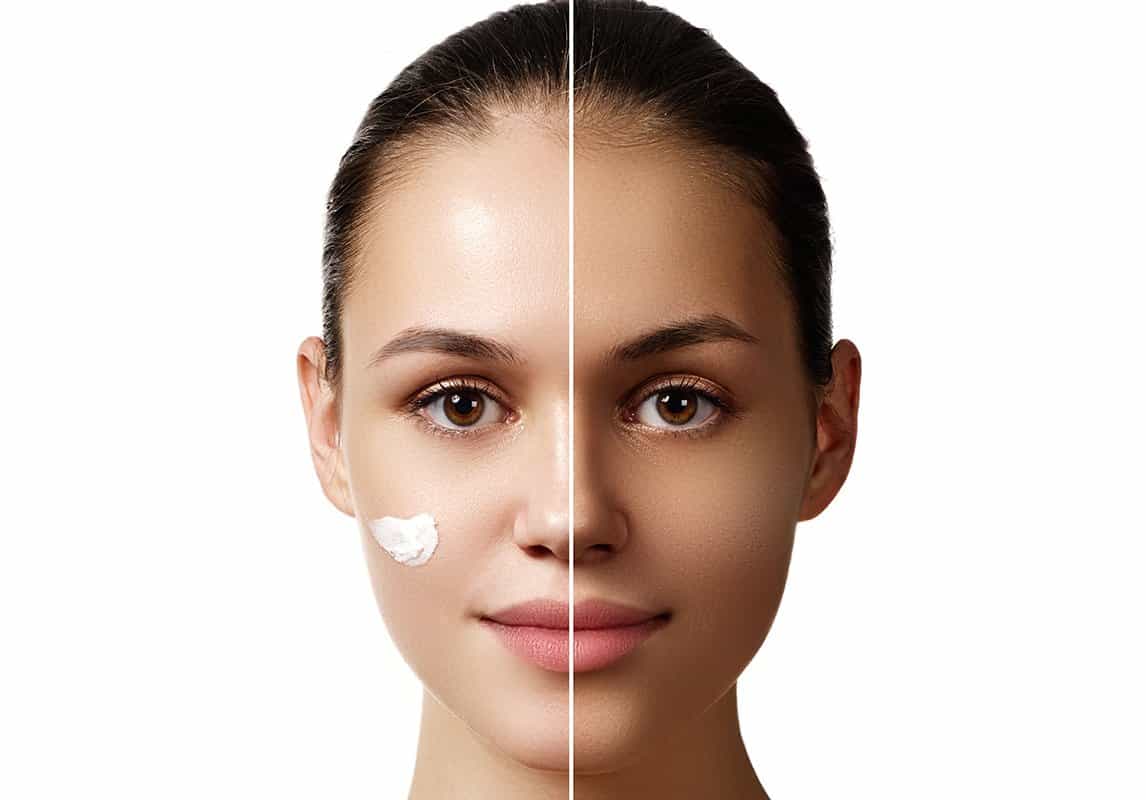 وصفات تفتيح البشرة السمراء