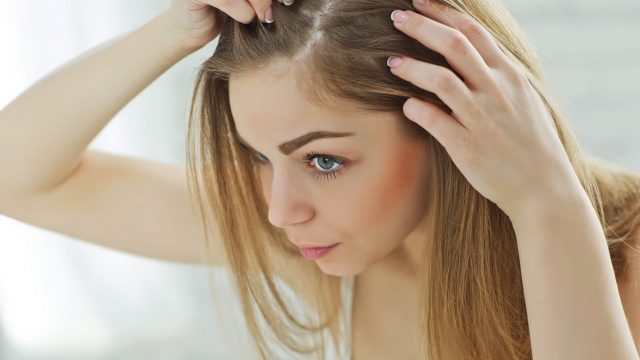 5 طرق بسيطة لاستعمال زيت الخروع لعلاج الصلع وتساقط الشعر