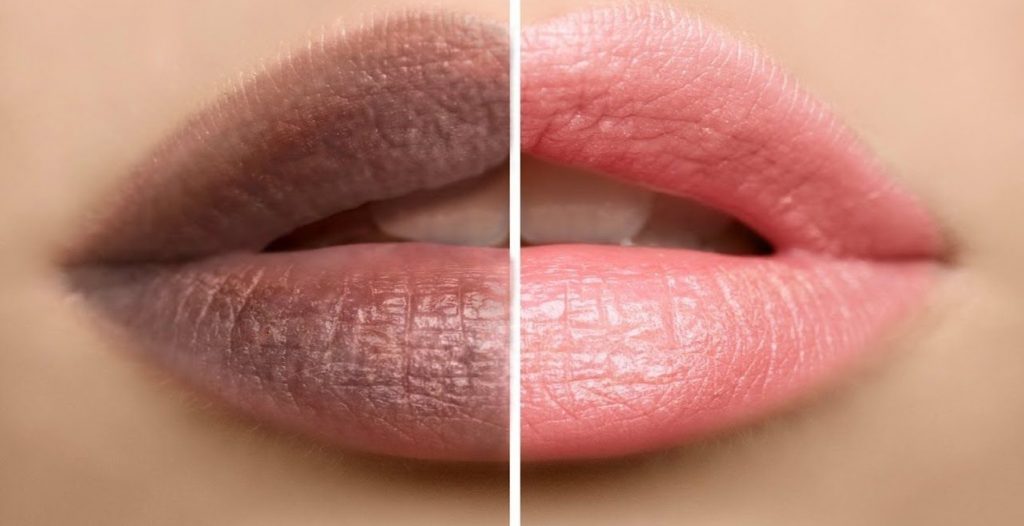 علاج سواد الشفايف : 3 طرق طبيعية لجعل شفتيك ورديتين في أسبوع