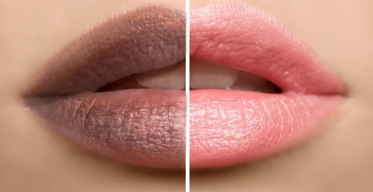 علاج سواد الشفايف : 3 طرق طبيعية لجعل شفتيك ورديتين في أسبوع