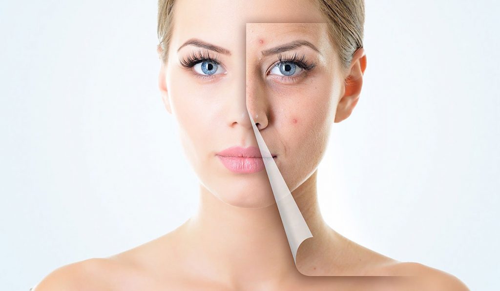 خطوات عمل الفراكشنال للوجه … عليك معرفتها