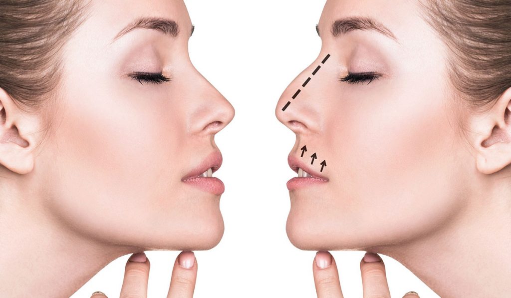 أفضل الطرق لتجميل الأنف دون جراحة