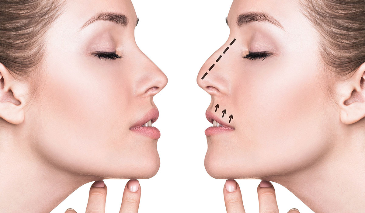 أفضل الطرق لتجميل الأنف دون جراحة