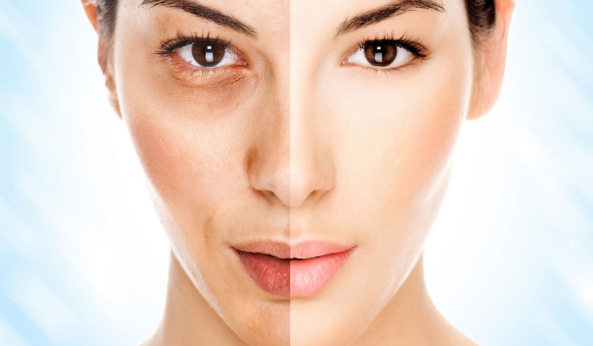 أفضل ماسكات تقشير الوجه في الشتاء