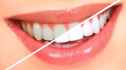 5 بدائل صحية لمعجون الأسنان للعناية بنظافة الفم