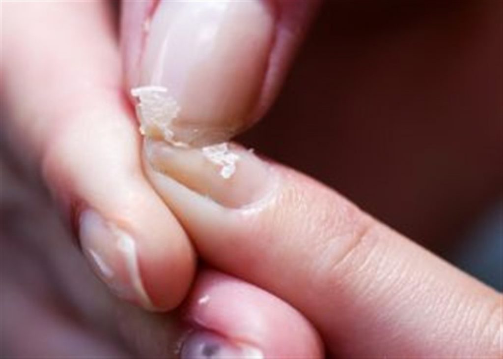 وصفات لعلاج تكسر الأظافر اللينة والهشة.. لا تفوتيها