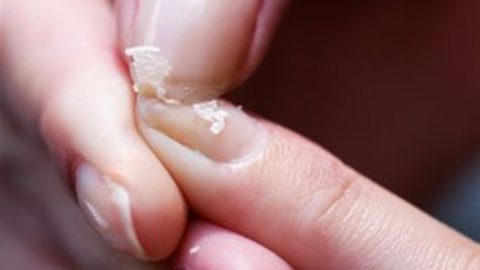 وصفات لعلاج تكسر الأظافر اللينة والهشة.. لا تفوتيها