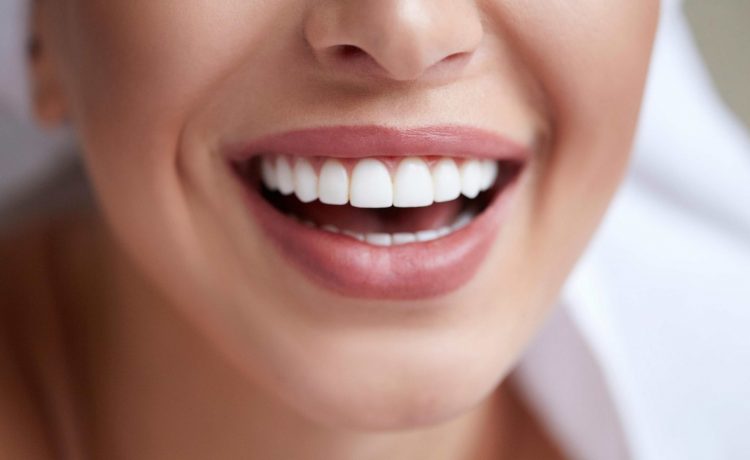 طرق طبيعية للتخلص من اصفرار الأسنان في شهر واحد