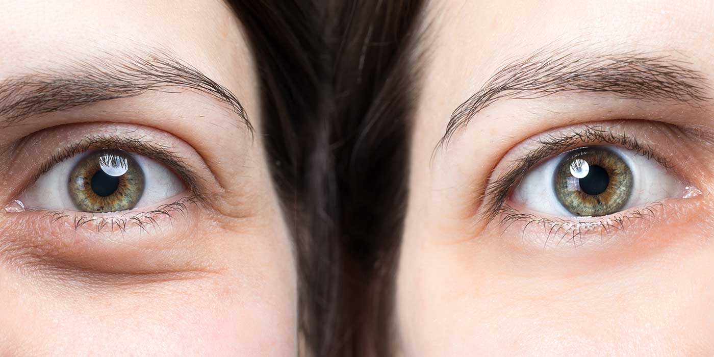 5 كريمات منزلية الصنع للعناية بمحيط العيون