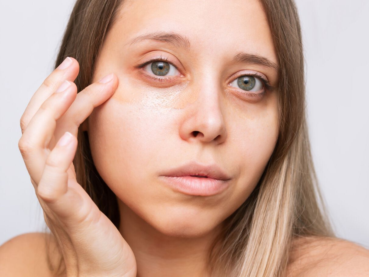 كيفية التخلص من الهالات السوداء