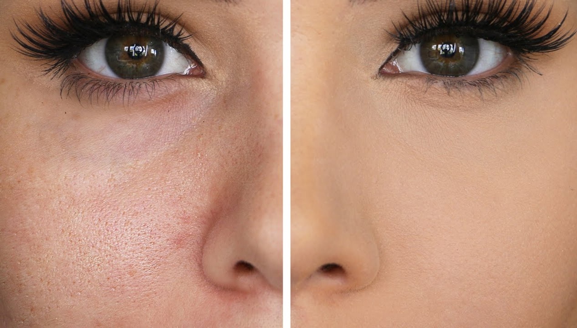 5 مكونات تشد المسام