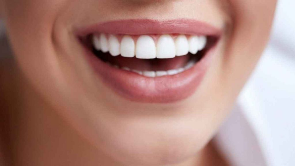مكونات طبيعية لتبييض الأسنان قبل حفل زفافك