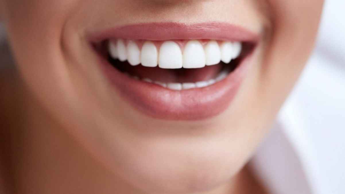 مكونات طبيعية لتبييض الأسنان قبل حفل زفافك