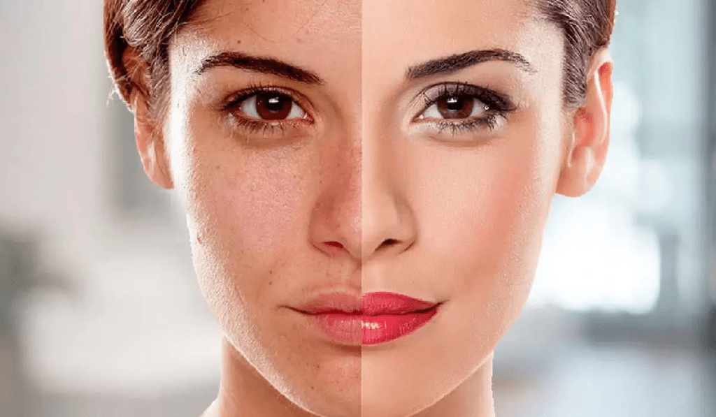 نصائح وخلطات طبيعية لتبييض البشرة الدهنية