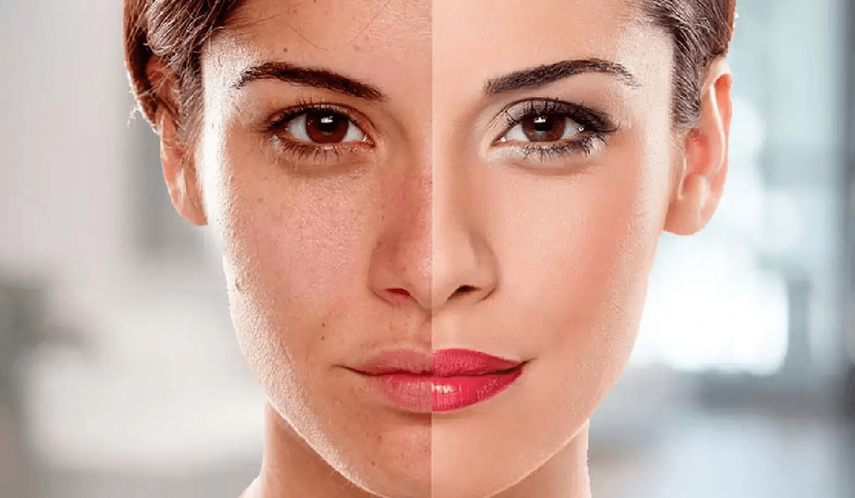 نصائح وخلطات طبيعية لتبييض البشرة الدهنية