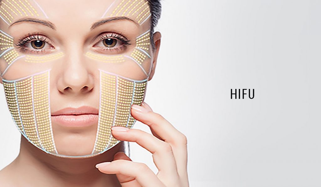 تقنية الهايفو HIFU لشد الوجه وكل ما يجب أن تعرفيه عنها