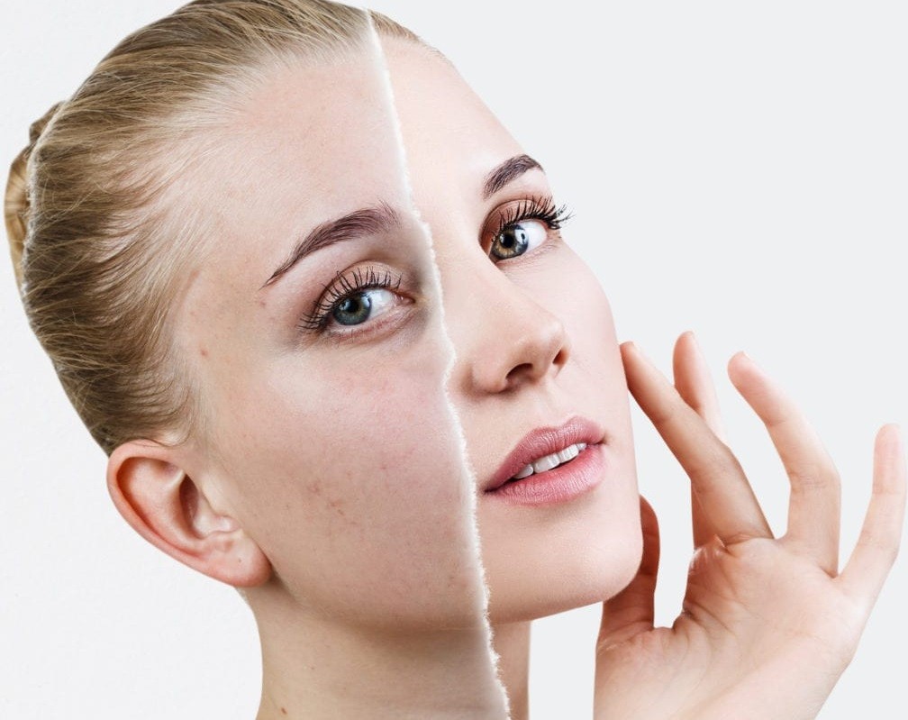 4 عادات تسرع شيخوخة البشرة