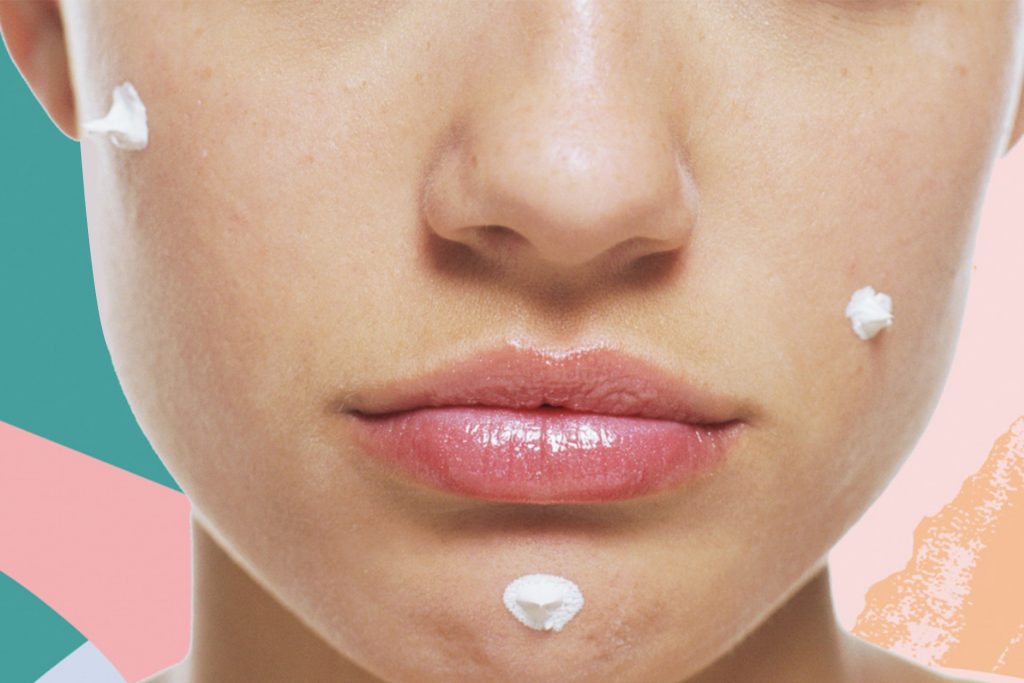 وصفات طبيعية للتخلص من حب الشباب نهائيًا قبل حفل زفافك