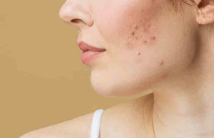 أفضل قناع بياض البيض