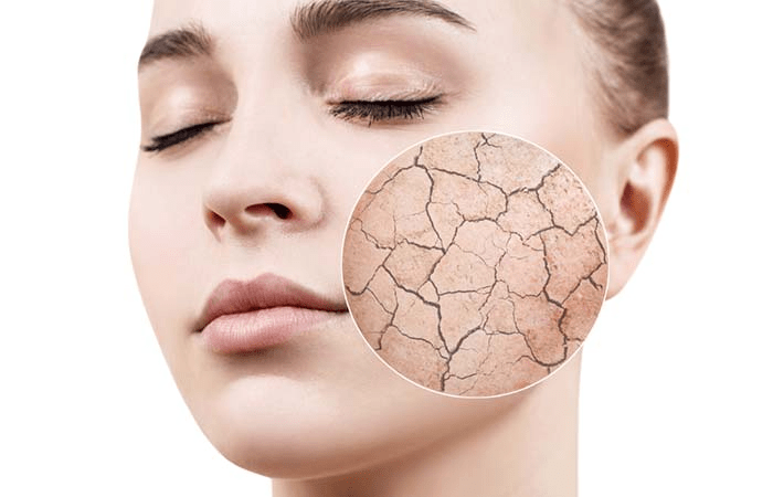 فوائد الجليسرين للبشرة الدهنية