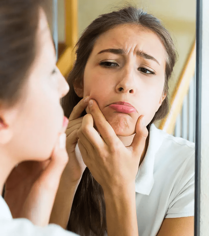 زيت الجوجوبا لعلاج حب الشباب