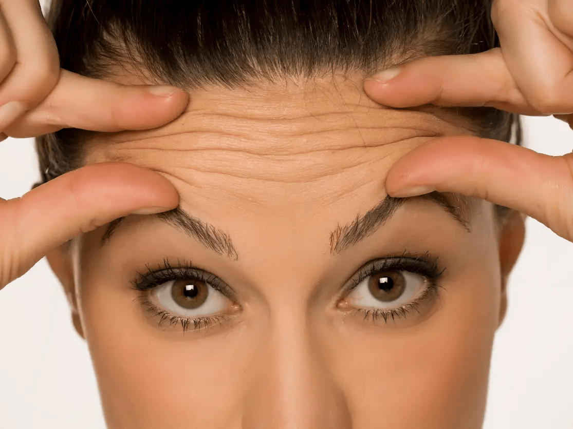 إزالة التجاعيد نهائيًا بأفضل الطرق الطبيعية