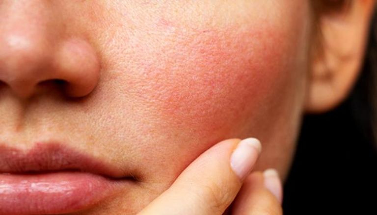 مكونات تضر البشرة الحساسة