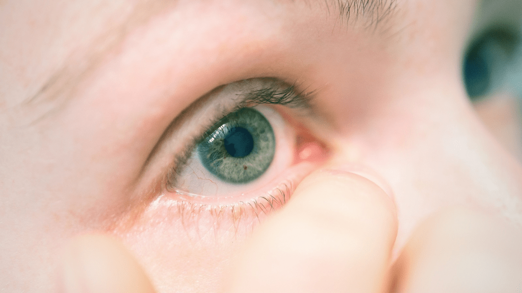 ودعي الهالات السوداء قبل الزفاف